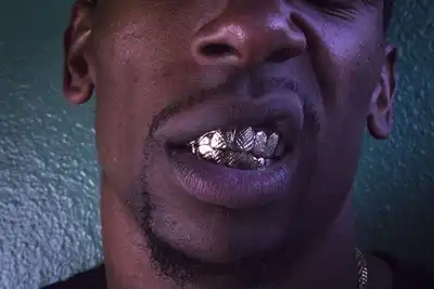 How Much Is Gold Teeth In South Africa